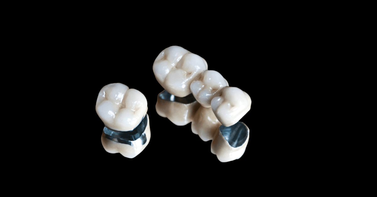 Crown compared with a bridge
